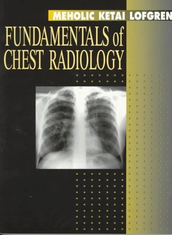 Fundamentals of Chest Radiology (Fundamentals of Radiology) Medicine