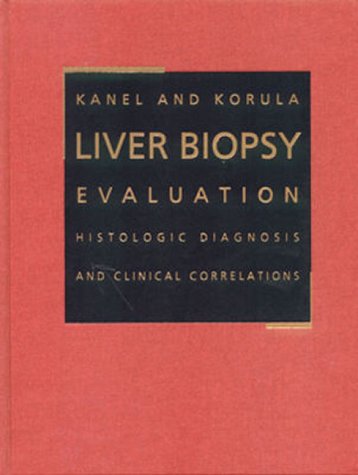 Liver Biopsy Evaluation: Histological Diagnosis and Clinical Correlations Medicine