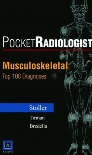 Pocketradiologist Musculoskeletal. Top 100 Diagnoses book