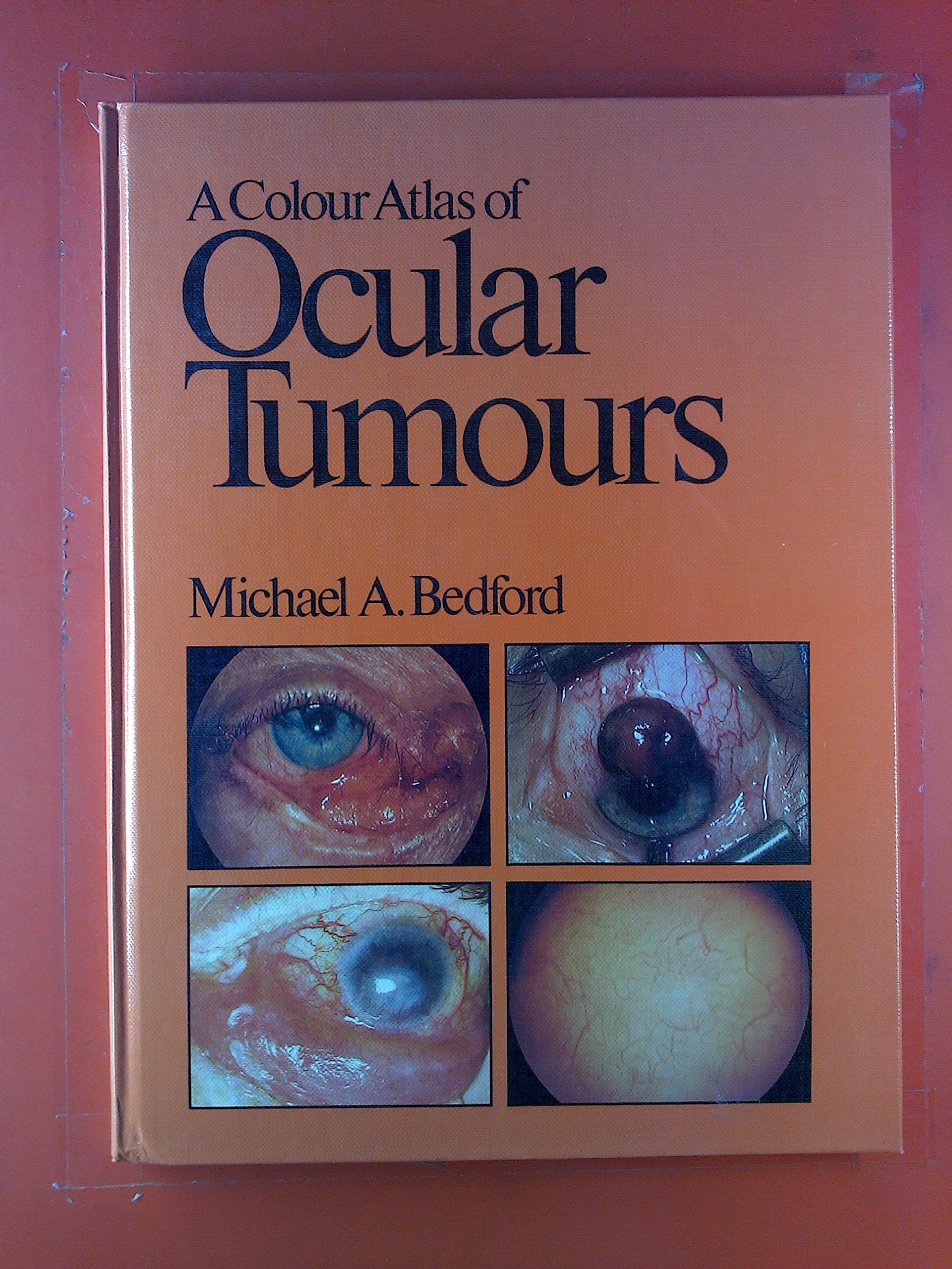 A Colour Atlas of Ocular Tumours (Wolfe medical atlases) Medicine