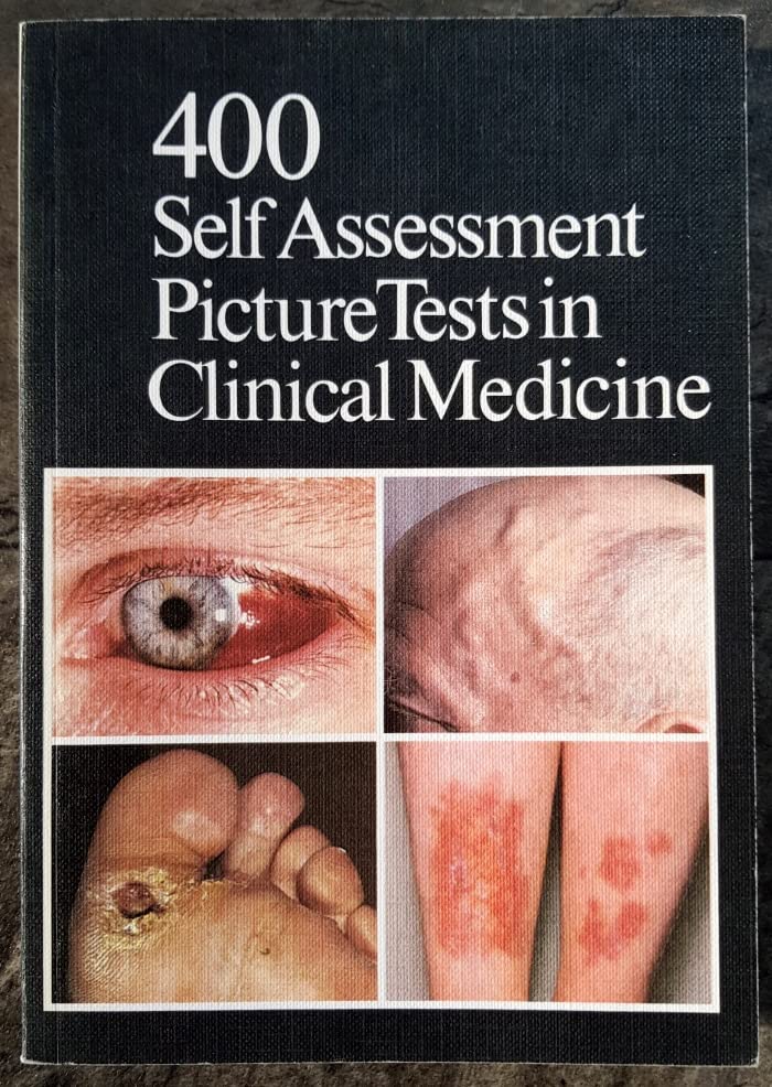 Four Hundred Self-assessment Picture Tests in Clinical Medicine: v. 1 Medicine