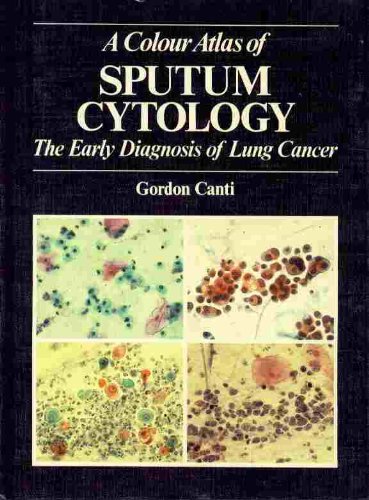 Atlas of Sputum Cytology Medicine