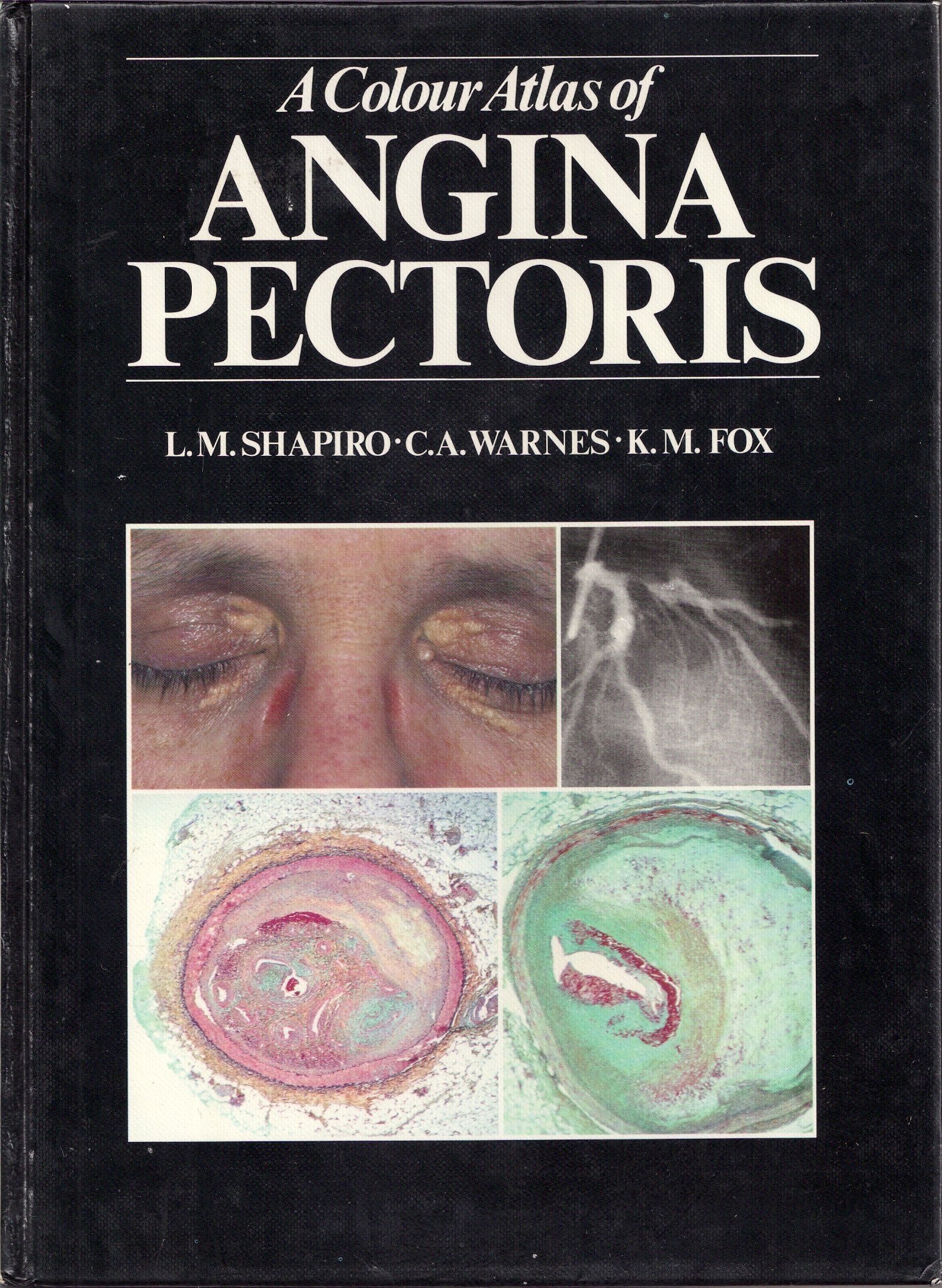 A Colour Atlas of Angina Pectoris Medicine