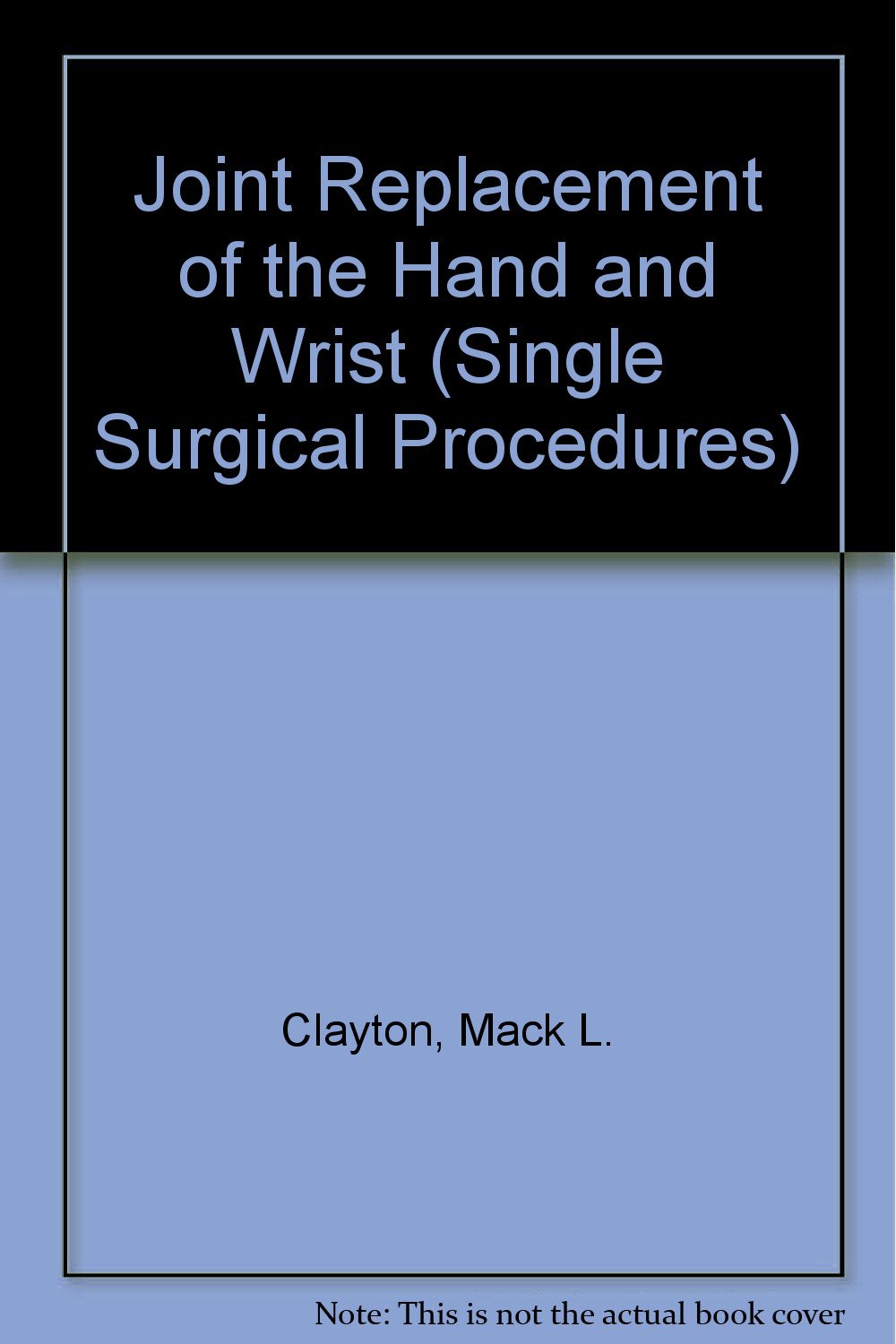 Joint Replacement of the Hand and Wrist (Single Surgical Procedures, Band 41) Medicine