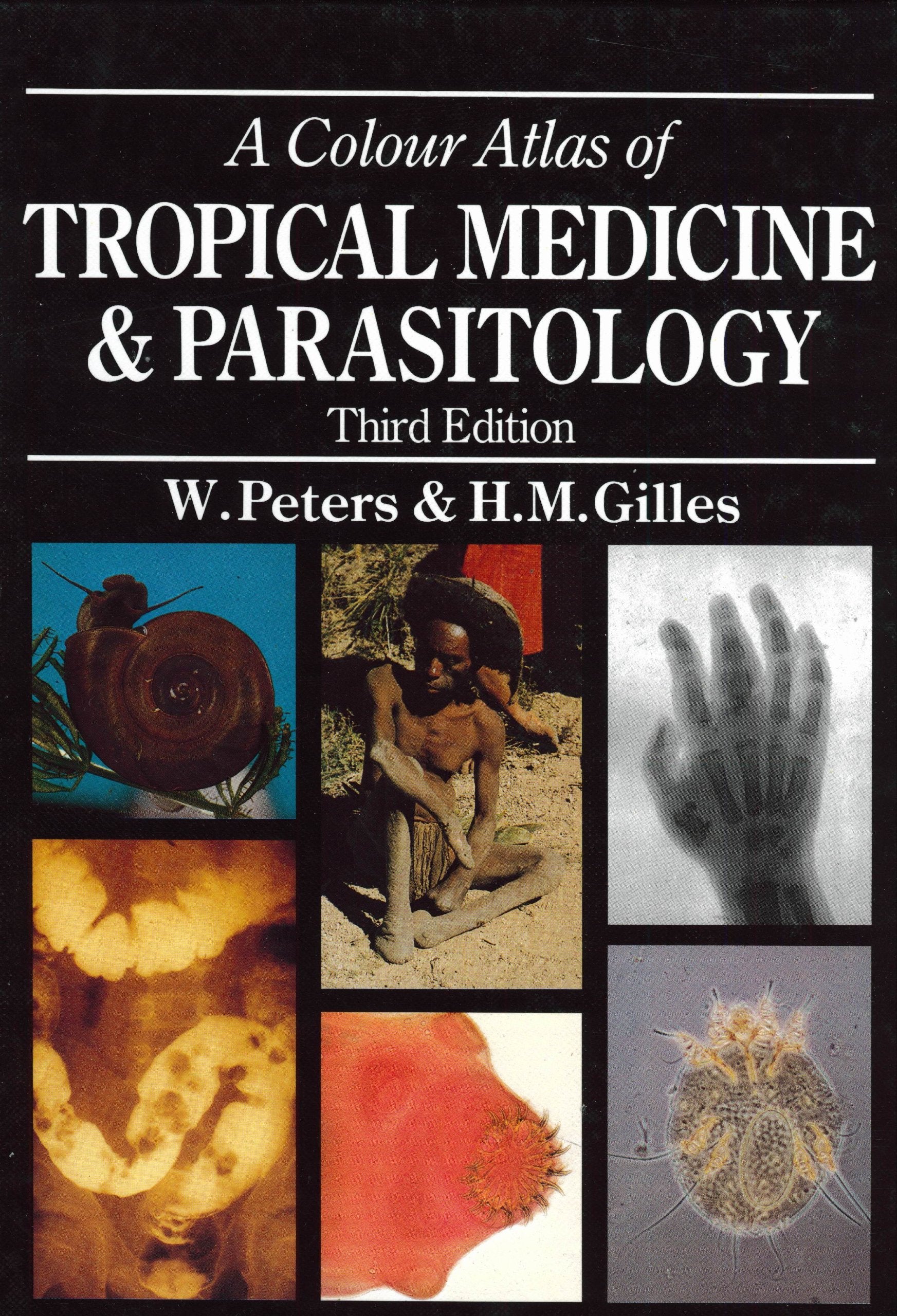 Color Atlas of Tropical Medicine and Parasitology Medicine