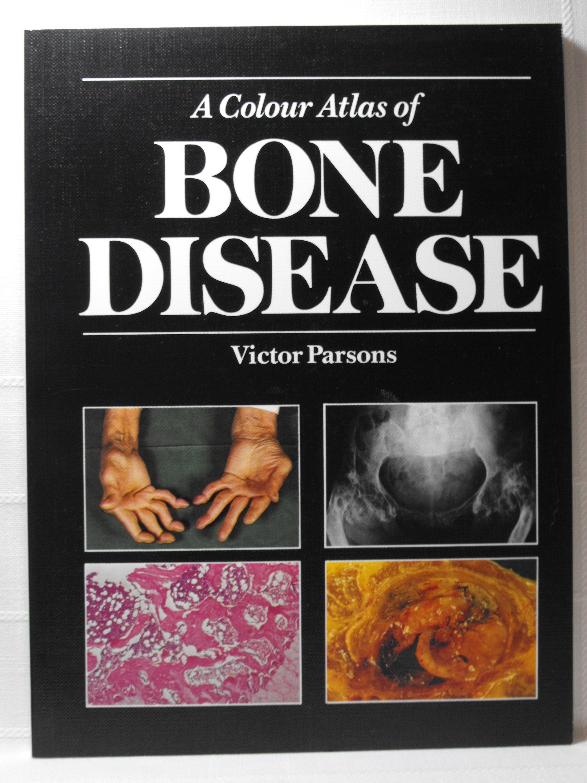 A Colour Atlas of Bone Disease book