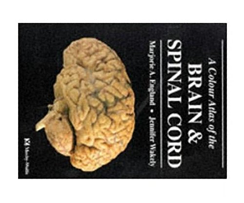 A Colour Atlas of Brain and Spinal Cord Medicine