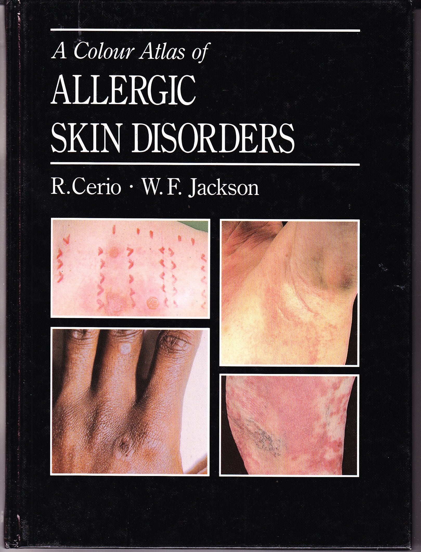 A Colour Atlas of Allergic Skin Disorders Medicine