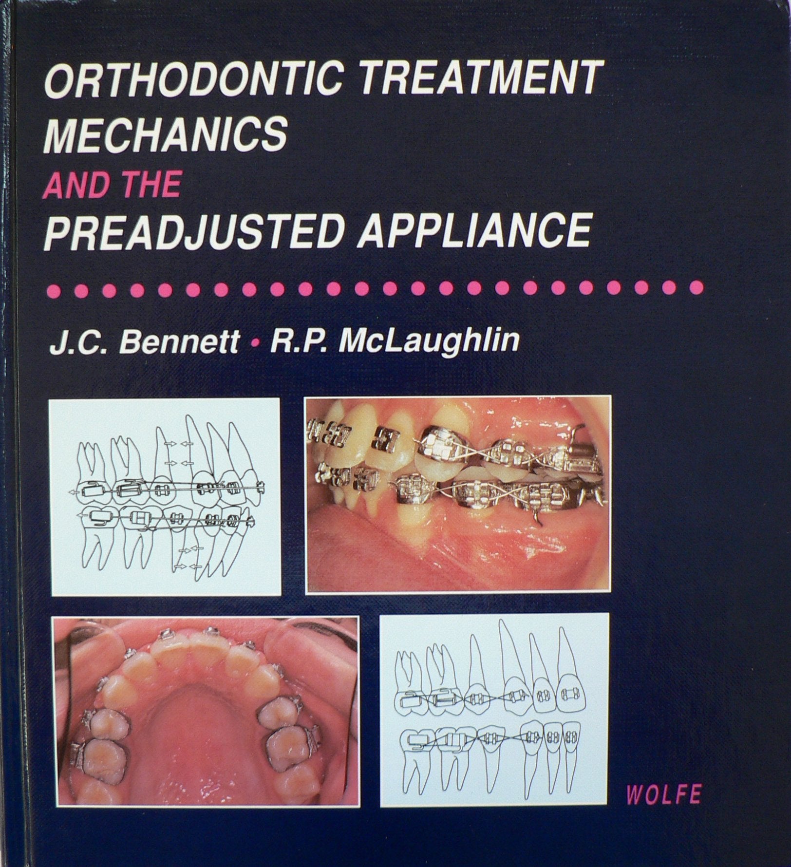 Orthodontic Treatment Mechanics and Preadjusted Appliances book
