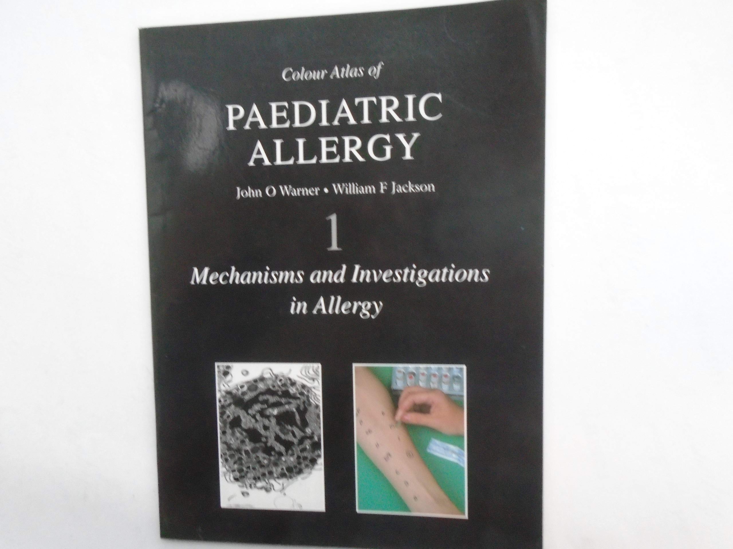 Color Atlas of Pediatric Allergy Medicine