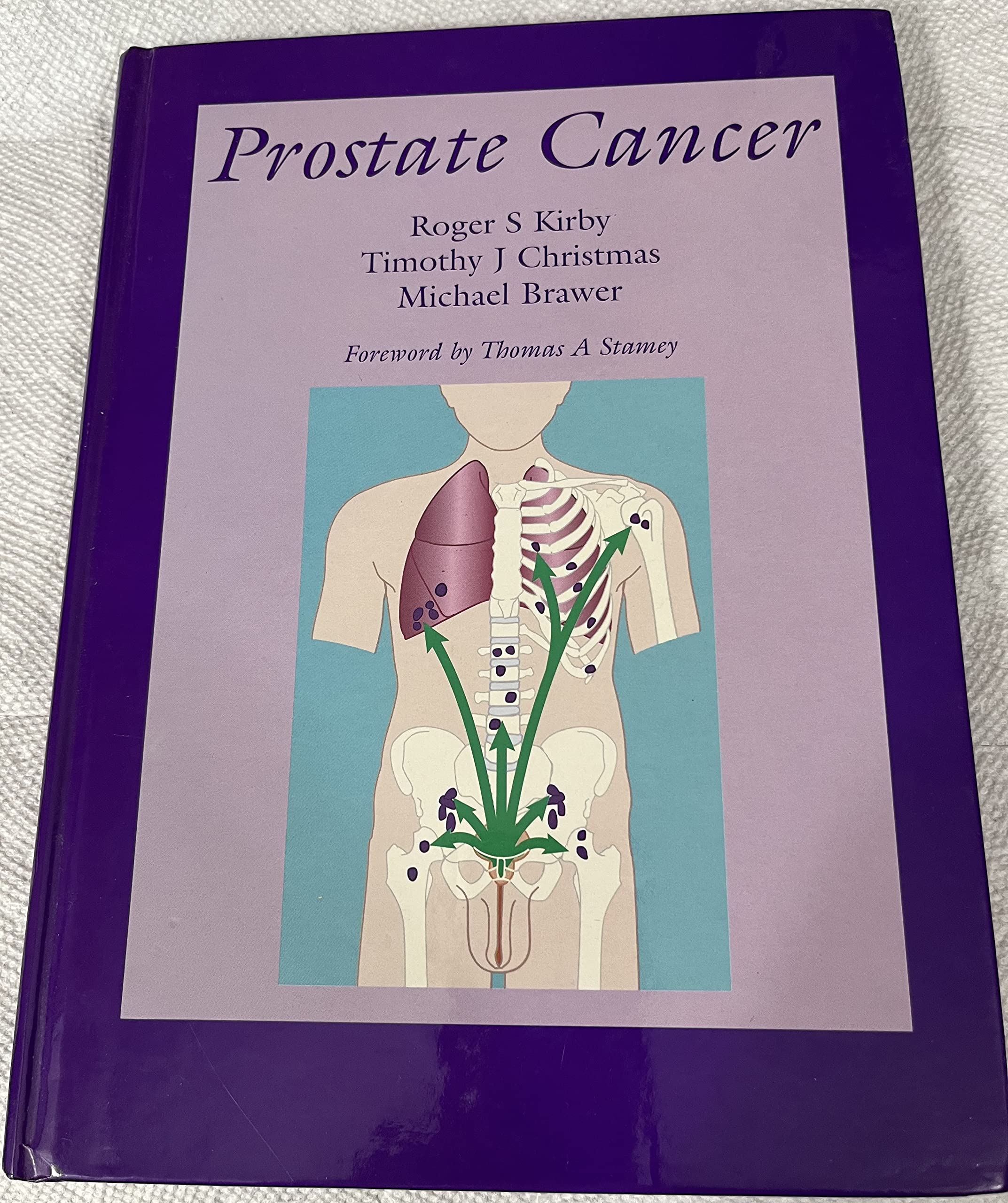 Product Image: Prostate Cancer