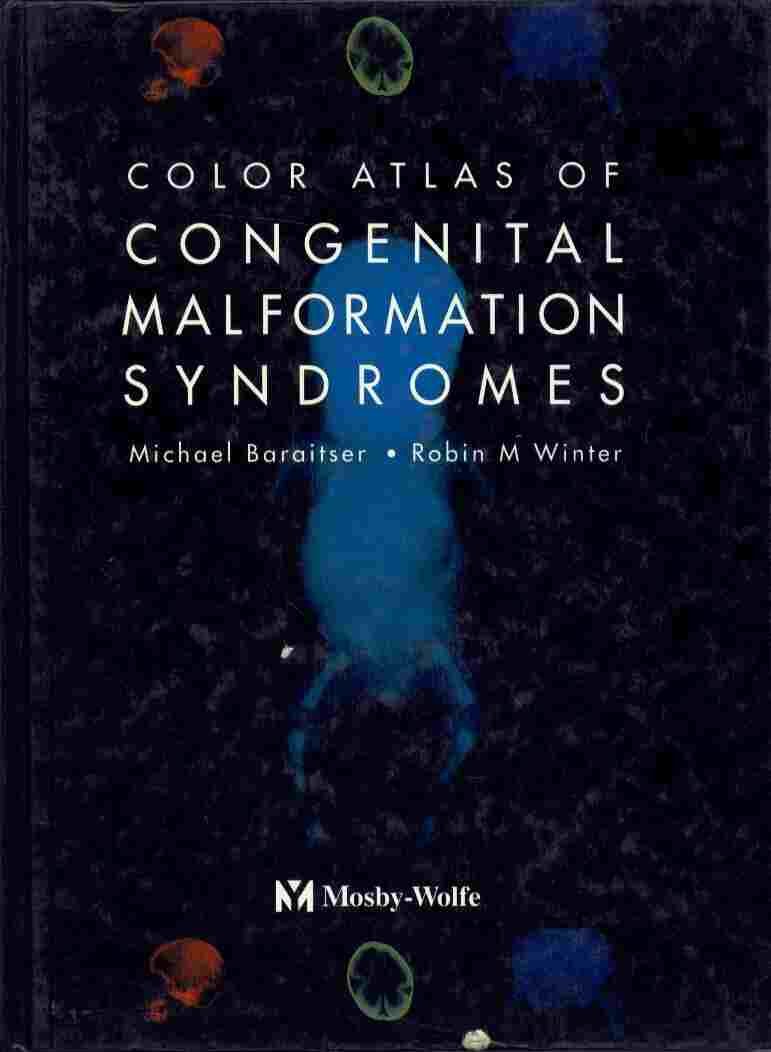 Color Atlas Of Congenital Maformations Syndrome book