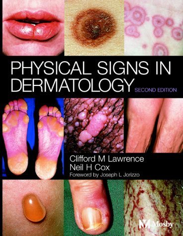 Physical signs in dermatology: Forew. by Joseph L. Jorizzo Medicine