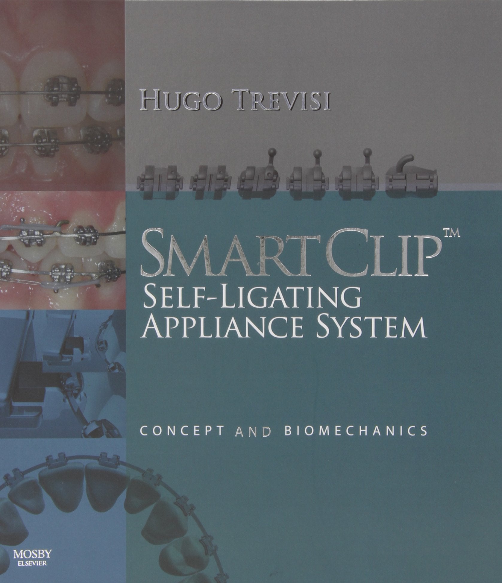 Smartclip Self-ligating Appliance System: Concept and Biomechanics Medicine