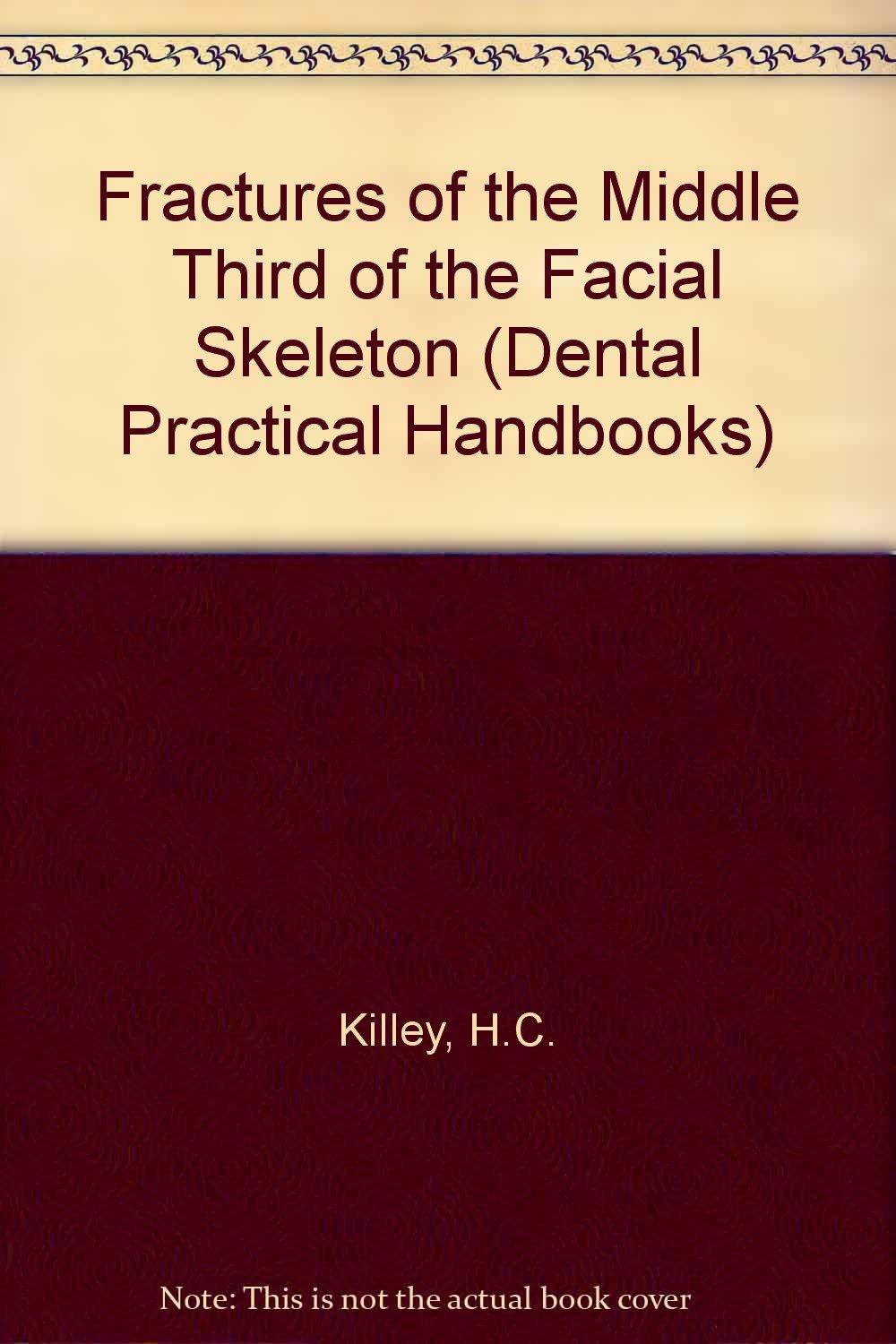 Fractures of the Middle Third of the Facial Skeleton (Dental Practical Handbooks) Books