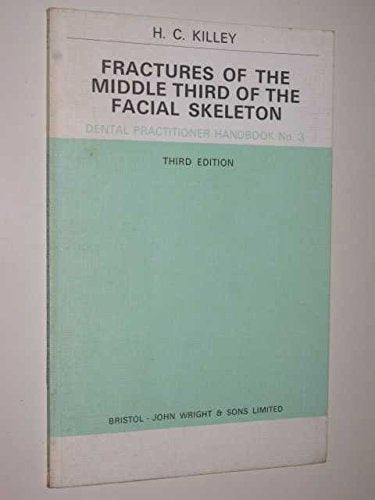 Fractures of the Middle Third of the Facial Skeleton (Dental Practical Handbooks) Books