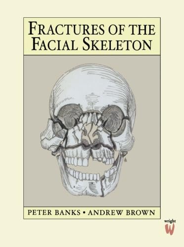 Fractures of the Facial Skeleton, 1e Medicine