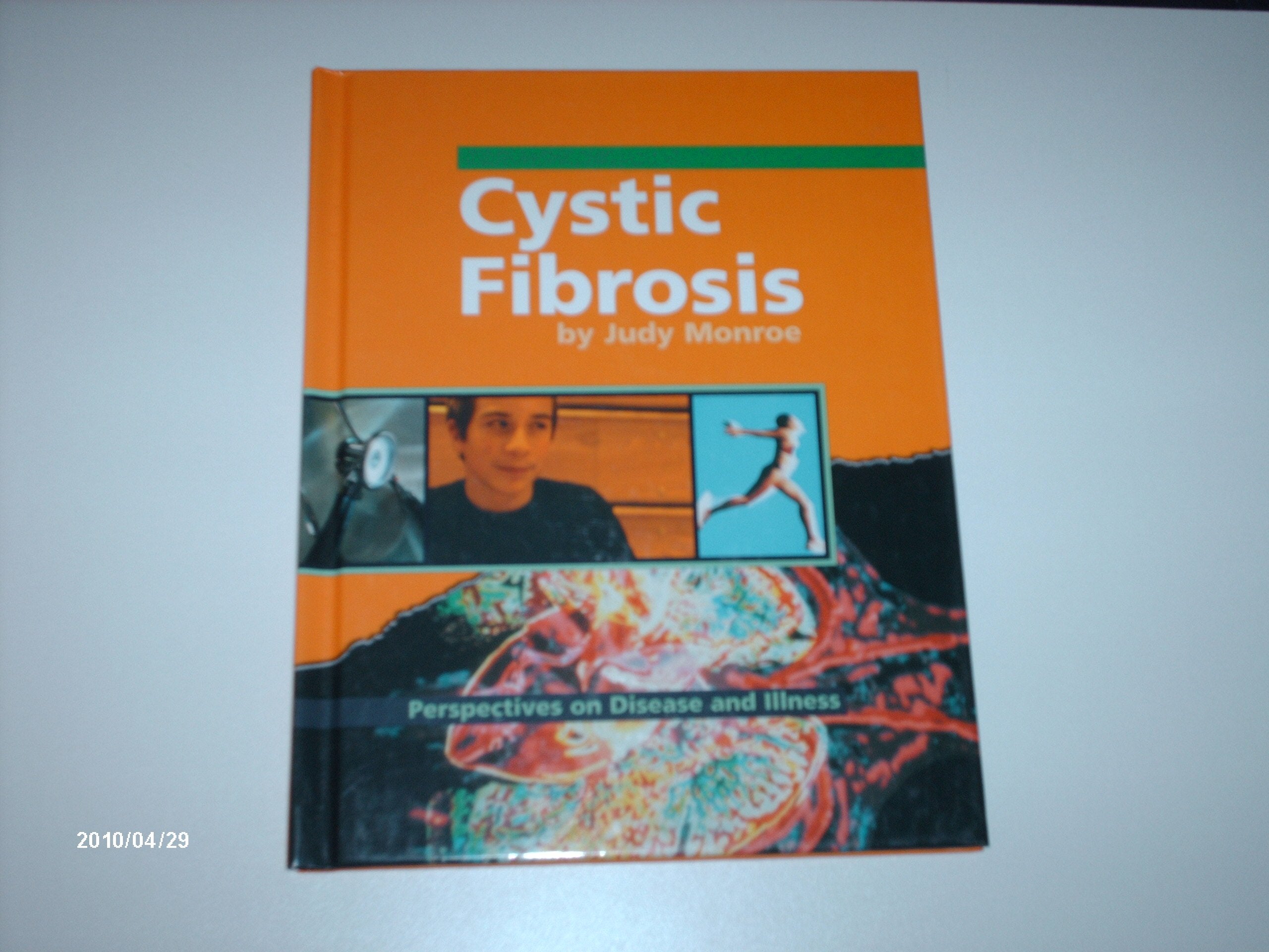 Cystic Fibrosis (Perspectives on Disease and Illness) Non-fiction
