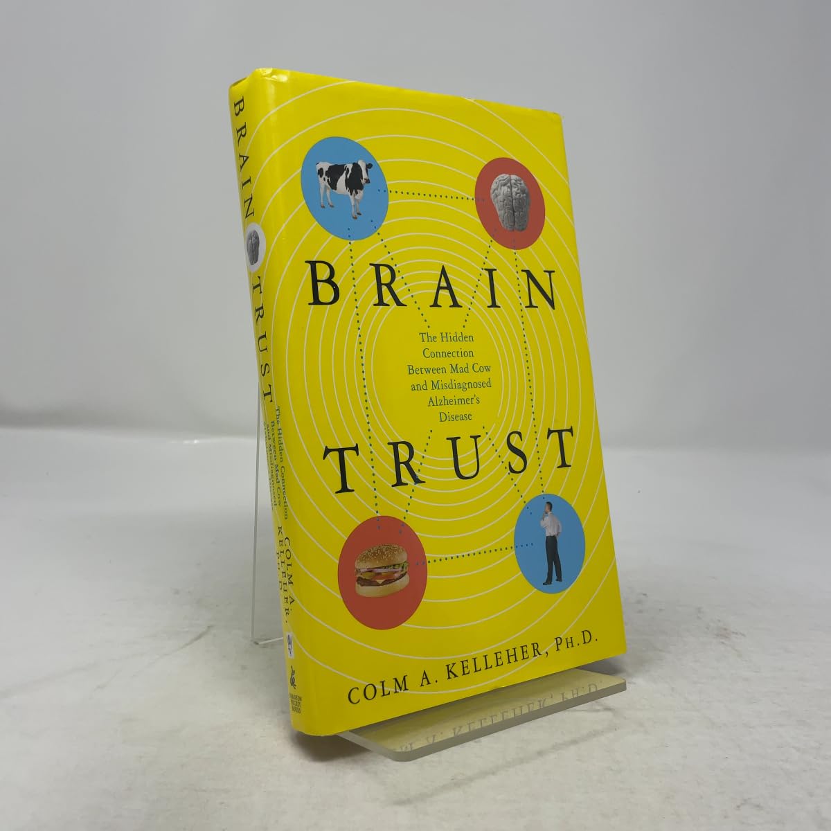 Brain Trust: The Hidden Connection Between Mad Cow and Misdiagnosed Alzheimer's Disease Medicine