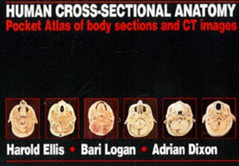 Human Cross-Sectional Anatomy Pocket Atlas: Body Sections and Ct Images Philosophy
