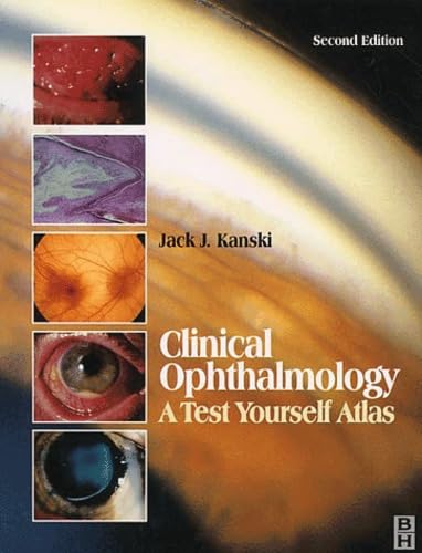 Clinical Ophthalmology: A Test Yourself Atlas Medicine