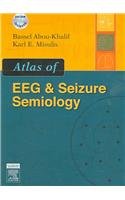Atlas of EEG & Seizure Semiology book