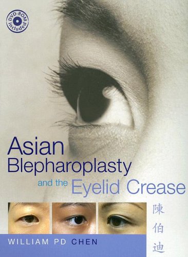 Asian Blepharoplasty And the Eyelid Crease Medicine