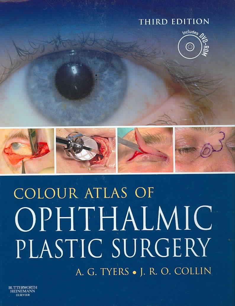 Colour Atlas of Ophthalmic Plastic Surgery with DVD book