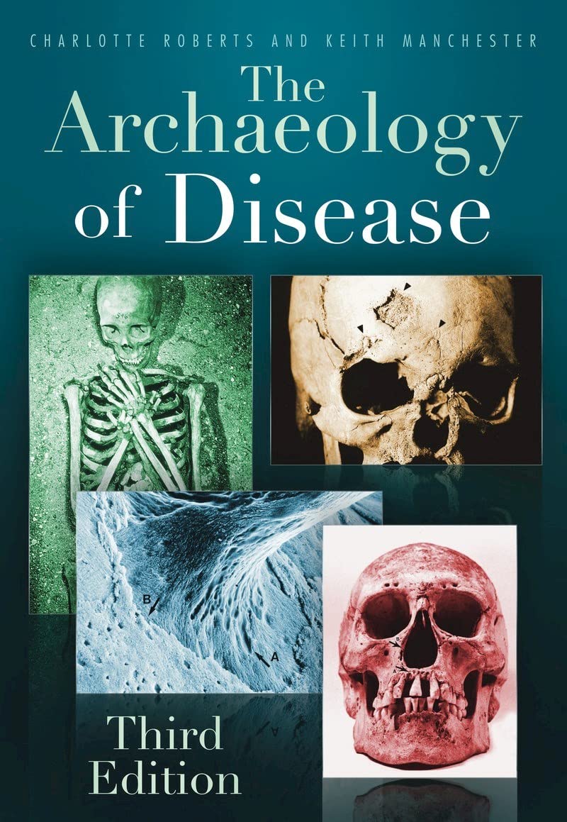 The Archaeology of Disease: Third Edition Medicine