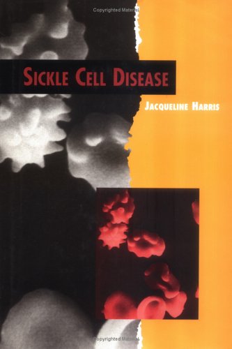 Sickle Cell Disease (Twenty-First Century Medical Library) Education