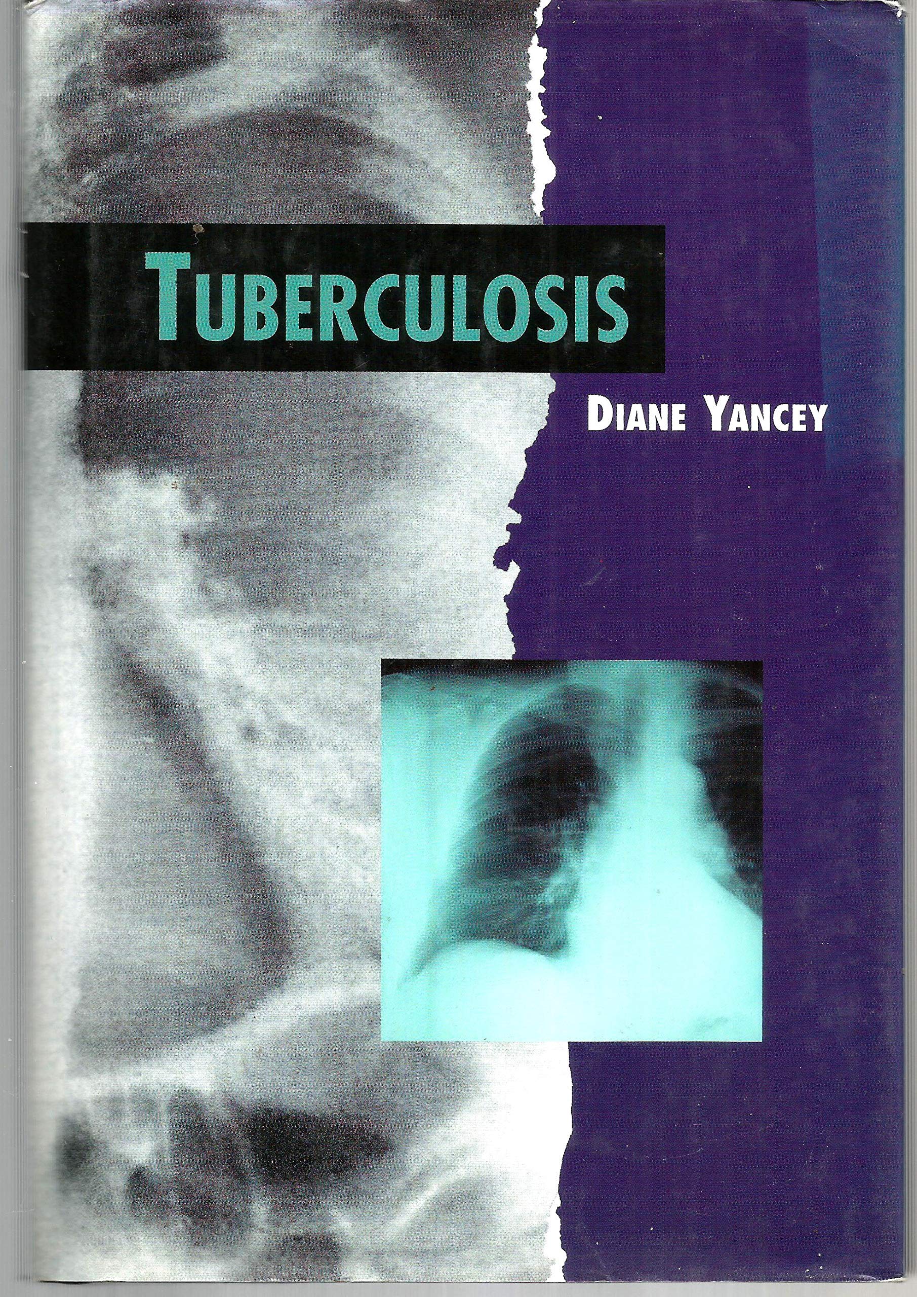 Tuberculosis (Twenty-First Century Medical Library) Education