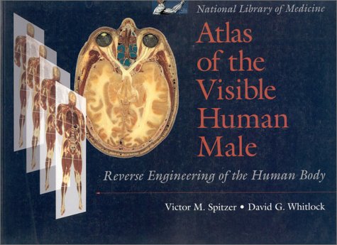Atlas of the Visible Human Male: Reverse Engineering of the Human Body Medicine