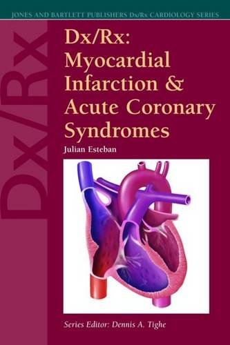 Dx/Rx: Myocardial Infarction And Acute Coronary Syndromes Medicine