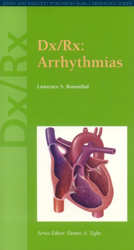 Dx/Rx: Arrhythmias (Dx/Rx Cardiology Series) Medicine