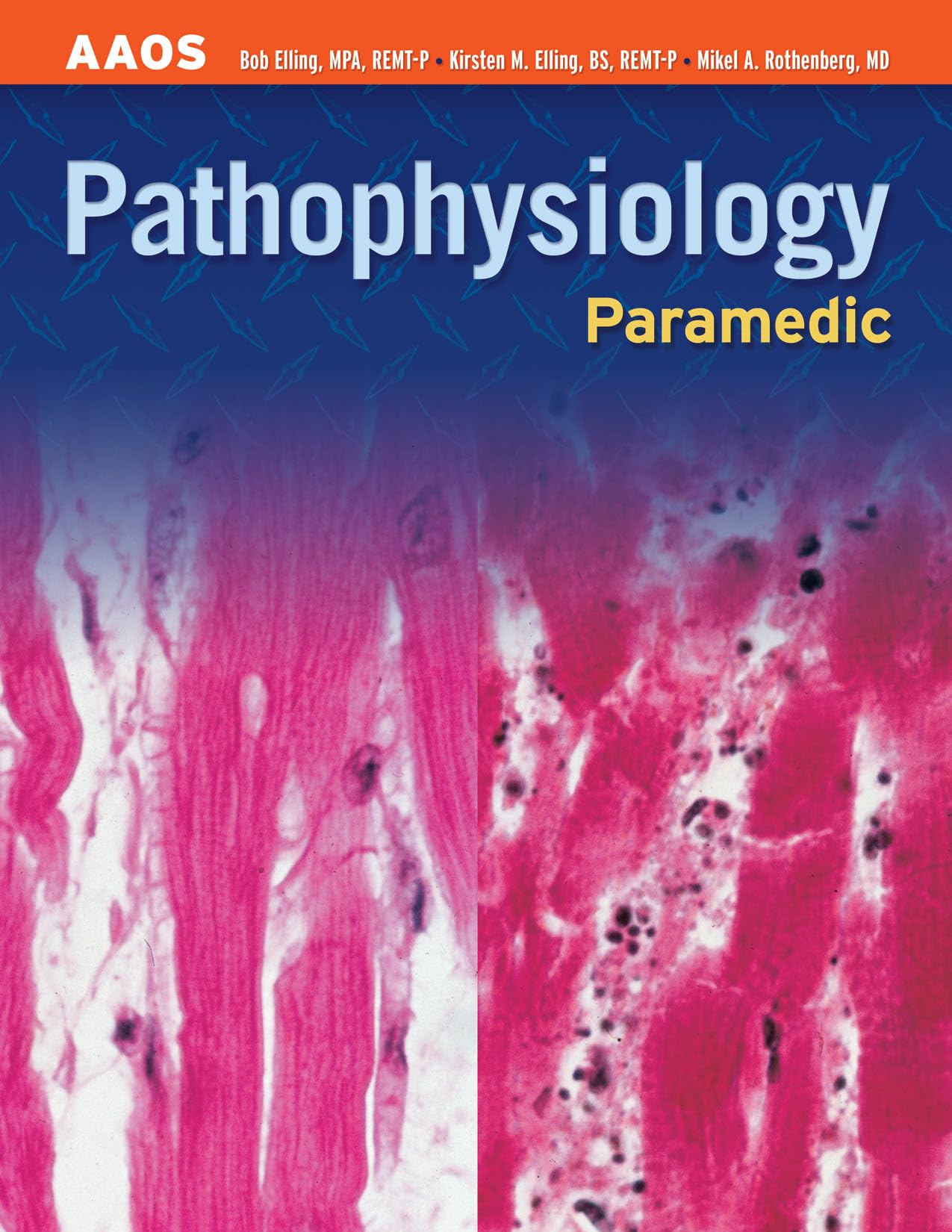 Paramedic: Pathophysiology (AAOS Paramedic) Medicine