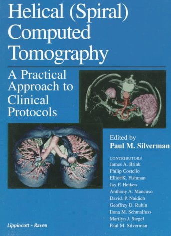 Product Image: Helical (Spiral) Computed Tomography: A Practical Approach to Clinical Protocols