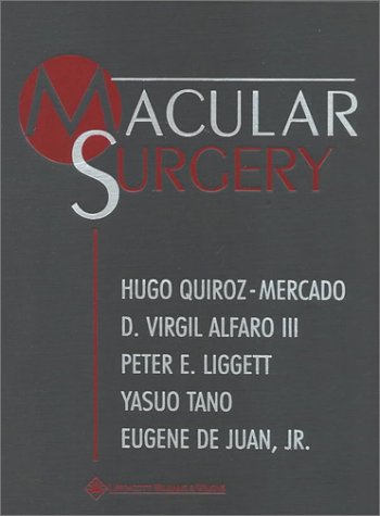 Product Image: Macular Surgery