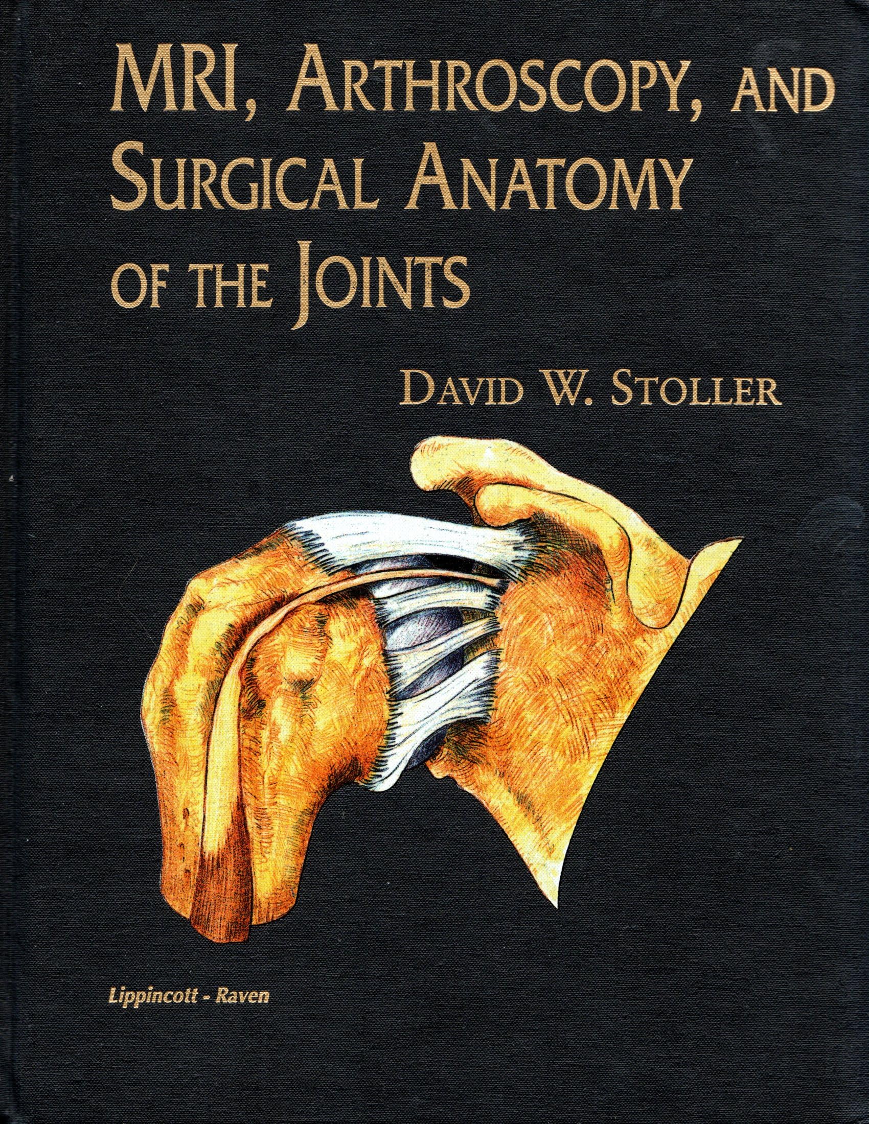 Mri, Arthroscopy, and Surgical Anatomy of the Joints Medicine
