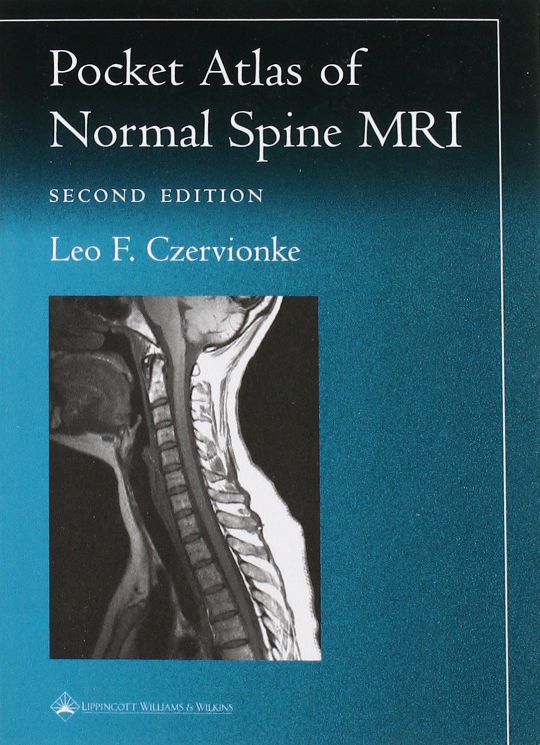 Pocket Atlas of Normal Spinal Mri book