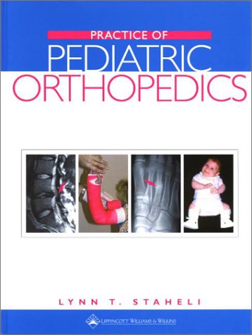 Practice of Pediatric Orthopedics Medicine