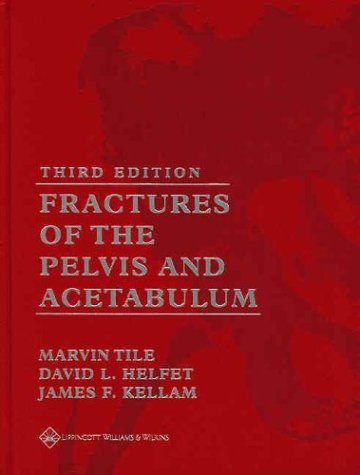 Fractures of the Pelvis and Acetabulum book