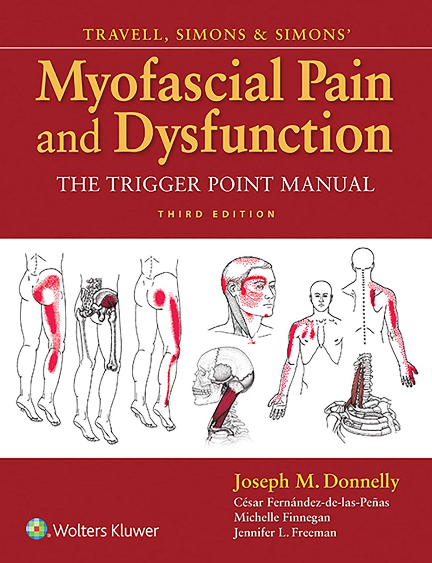 Travell, Simons & Simons' Myofascial Pain and Dysfunction Medicine