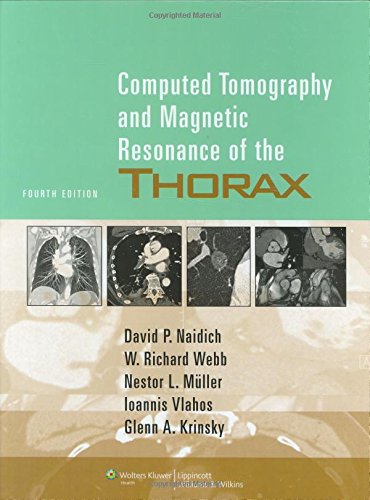 Computed Tomography and Magnetic Resonance of the Thorax Medicine