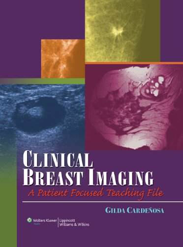 Clinical Breast Imaging: A Patient Focused Teaching File book