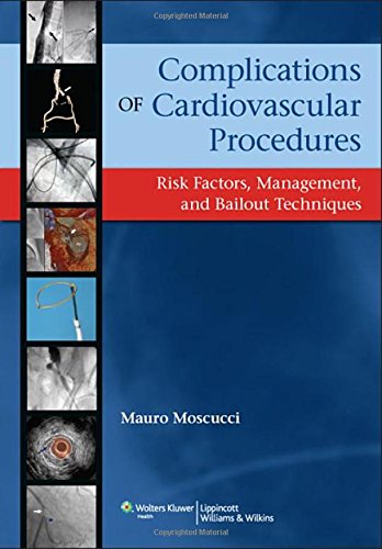 Complications of Cardiovascular Procedures: Risk Factors, Management, and Bailout Techniques Medicine
