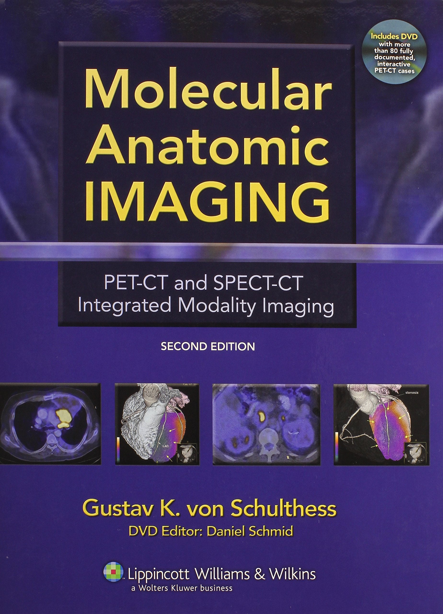 Molecular Anatomic Imaging: PET-CT And SPECT-CT Integrated Modality Imaging Medicine