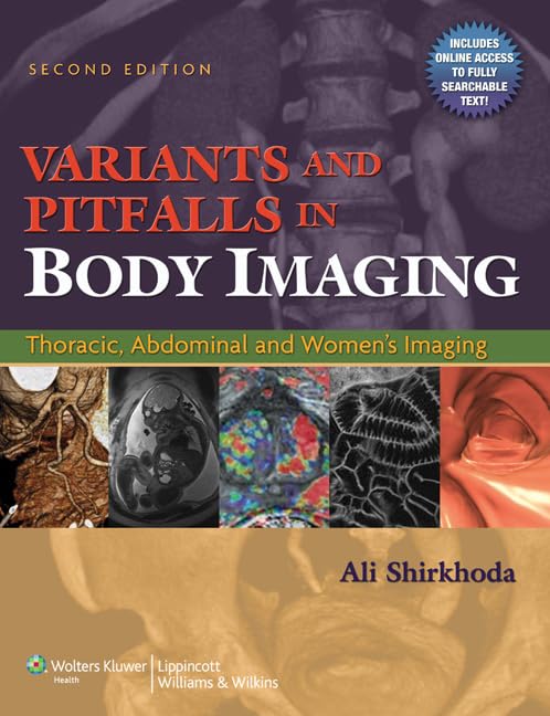 Variants and Pitfalls in Body Imaging: Thoracic, Abdominal and Women's Imaging book