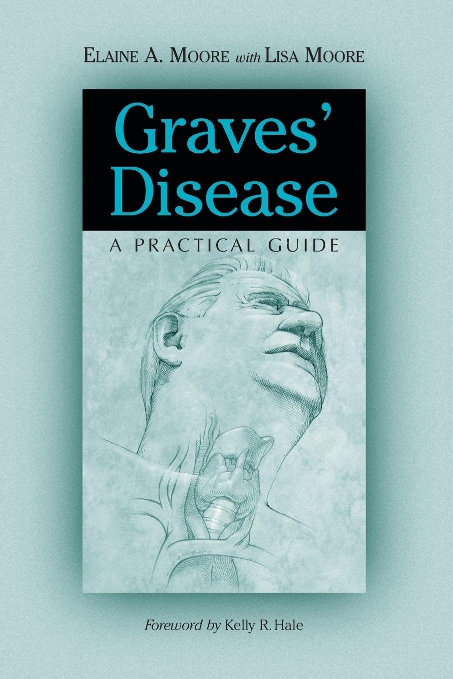 Graves' Disease: A Practical Guide (McFarland Health Topics) Medicine