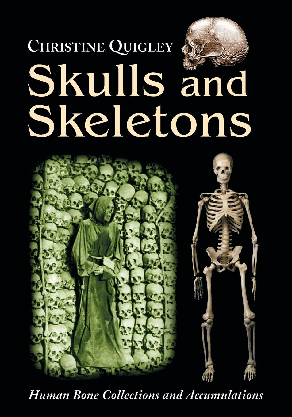 Skulls and Skeletons: Human Bone Collections and Accumulations Law