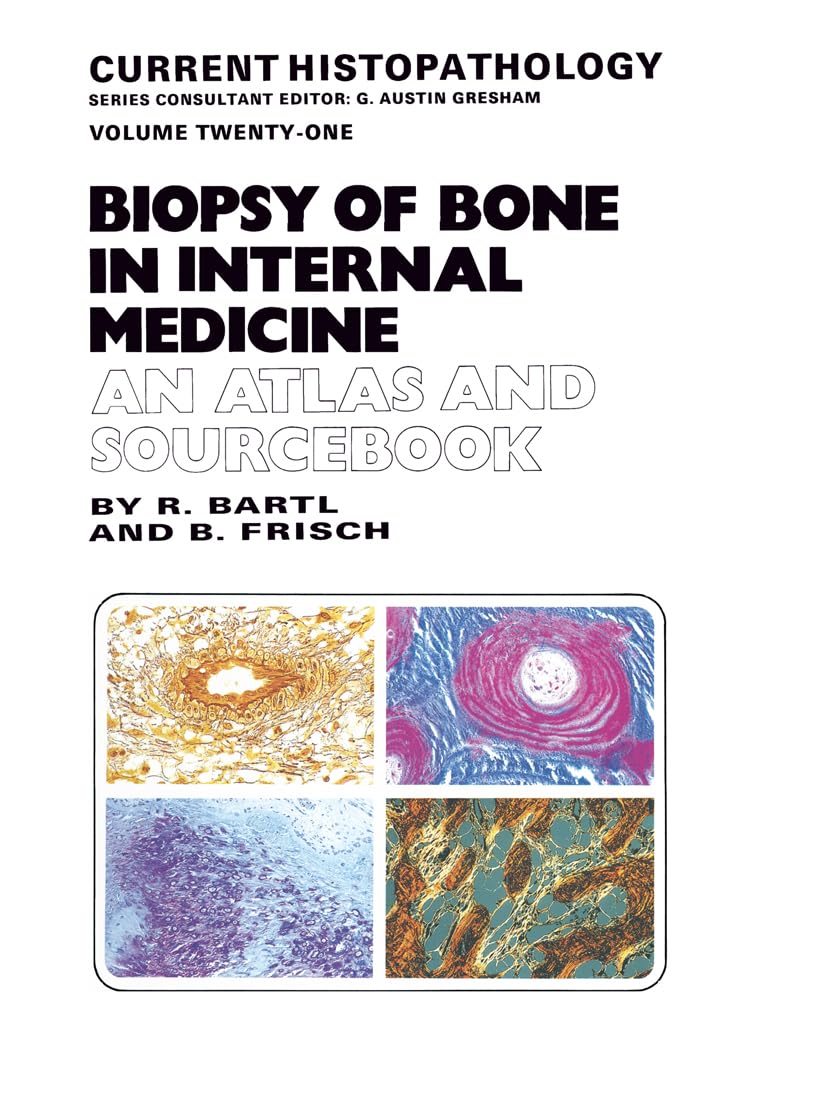 Biopsy of Bone in Internal Medicine: An Atlas and Sourcebook (Current Histopathology) Medicine